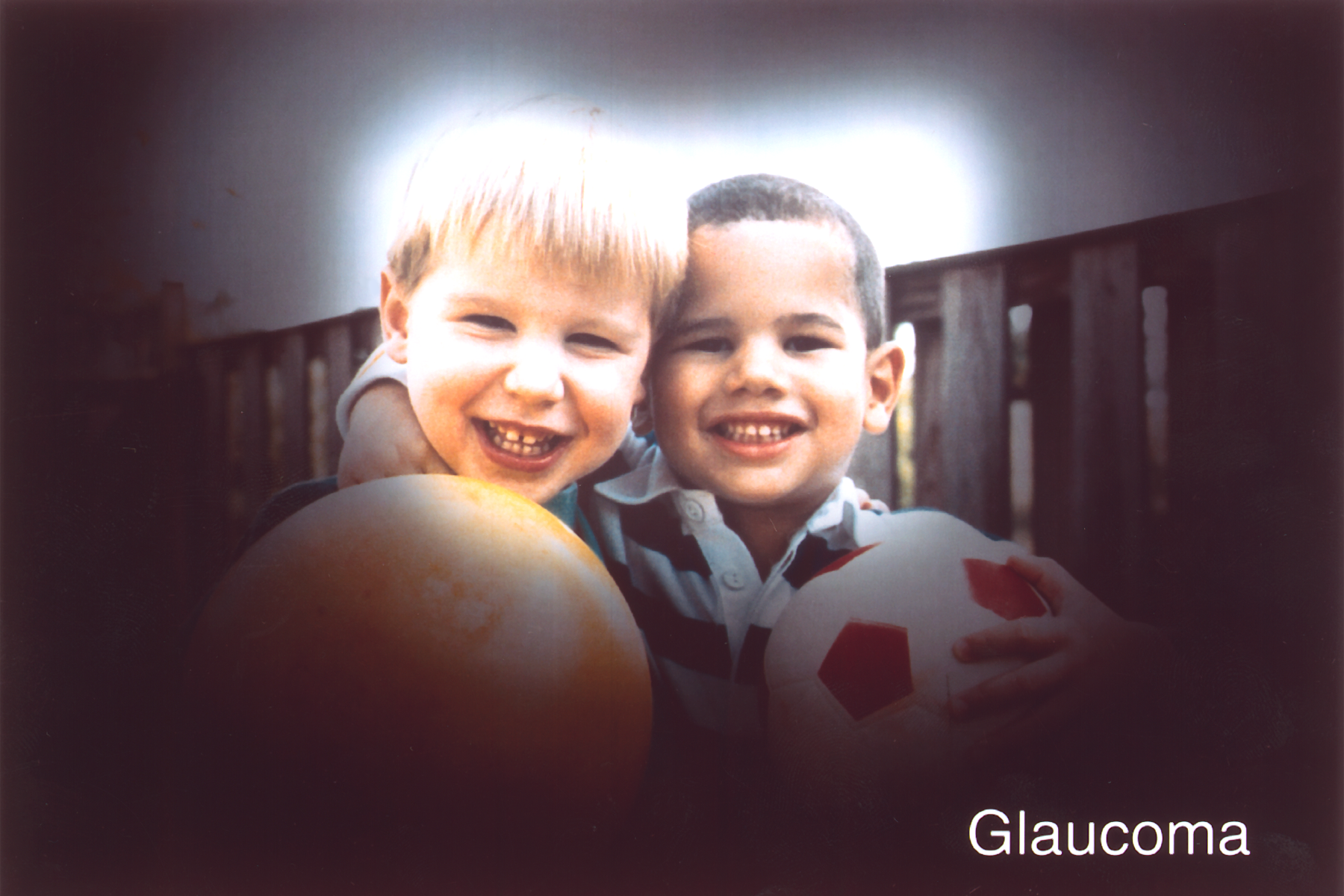 Vision loss caused by glaucoma